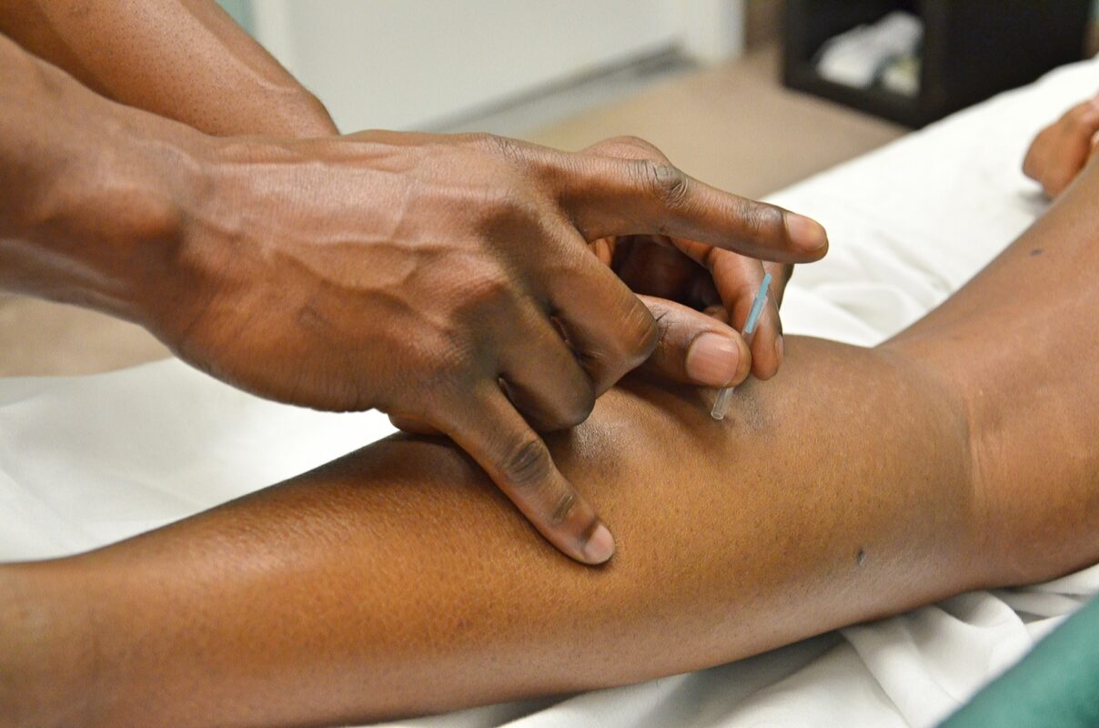 What Can Functional Dry Needling Do for You?