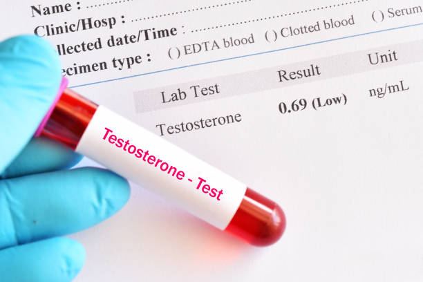 Understanding Low Testosterone: Causes, Symptoms, and Treatment Options